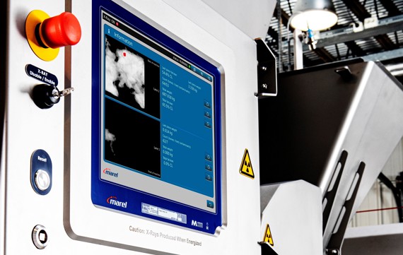 SensorX Magna X-ray bone detection displayed on screen
