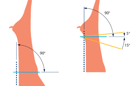 Angled Cutting Deboflex